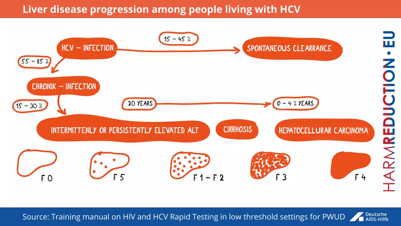 2 - Liver disease progression among people living with HCV